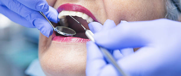 Best Broken or Cracked Tooth Emergency Dentist in Chevy Chase Heights, PA